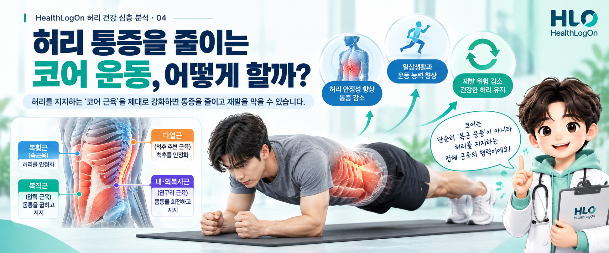 버드독과 브리지 같은 코어 운동을 보여주면서 허리 건강에 맞는 운동 강도 선택을 강조하는 대표이미지