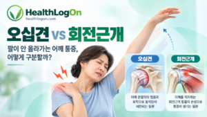 오십견과 회전근개 질환 차이 안내 이미지. 어깨 통증으로 불편해하는 여성과 어깨 관절낭 및 회전근개 힘줄의 구조를 비교한 HealthLogOn 건강정보 이미지