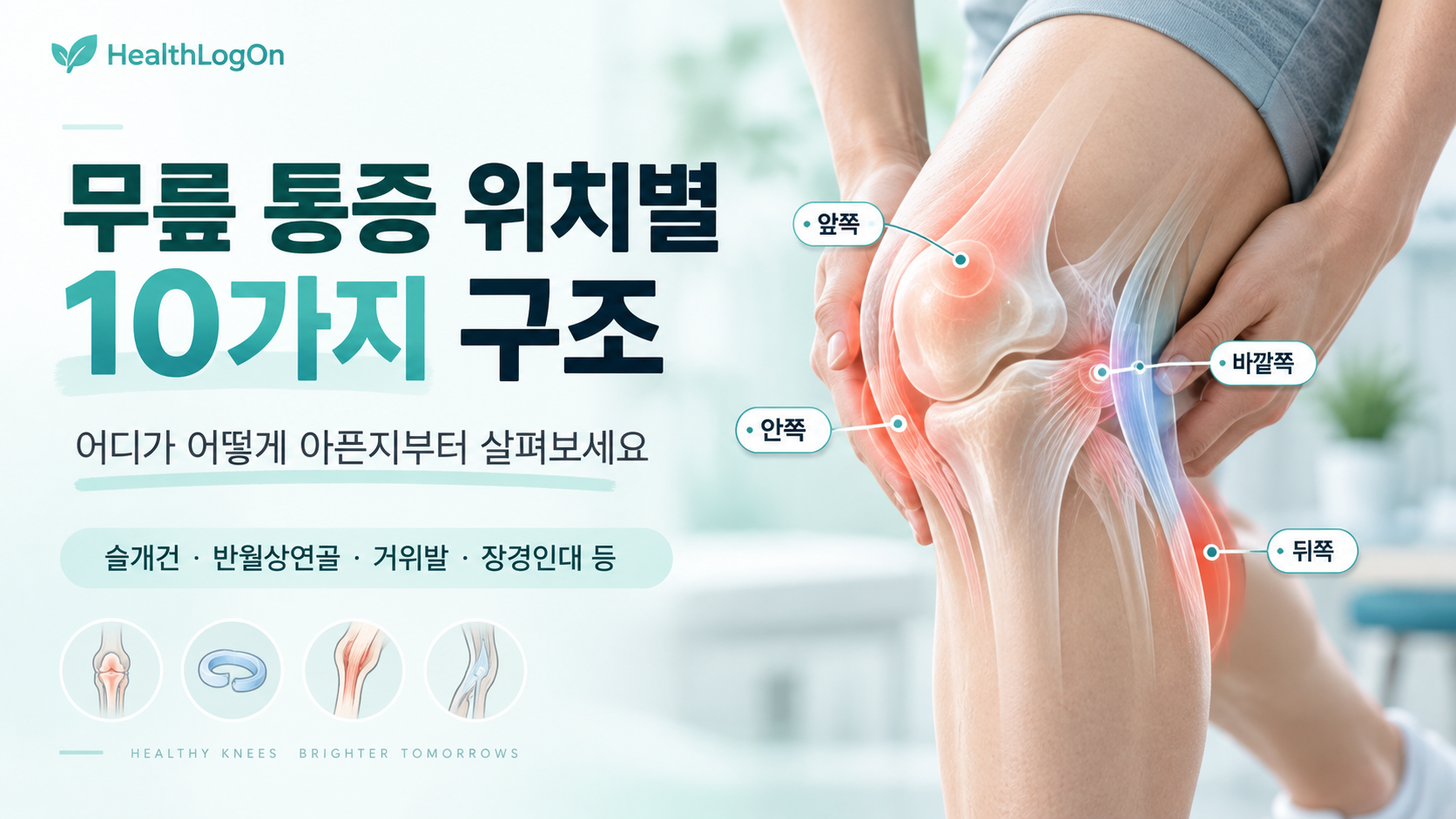 무릎 통증 위치별 10가지 구조를 소개하는 대표이미지로, 앞쪽·안쪽·바깥쪽·뒤쪽 통증 부위를 시각적으로 표시한 이미지