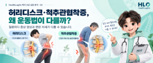 허리디스크와 척추관협착증의 개념 차이를 분리된 단순 구조 도식으로 보여주는 대표이미지